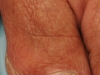 Nail Care 1
