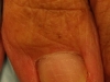 Nail Care 1