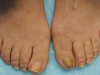 Nail Care 4