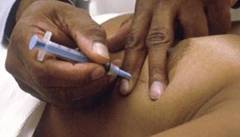 fine-needle-biopsy