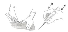 fine-needle-biopsy